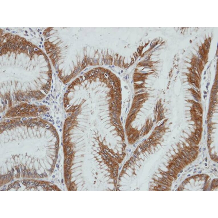 Immunohistochemistry - HSD3a antibody from Signalway Antibody (22100) - Antibodies.com