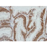 Immunohistochemistry - HSD3a antibody from Signalway Antibody (22100) - Antibodies.com