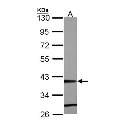 ZNF707 antibody from Signalway Antibody (22104) - Antibodies.com