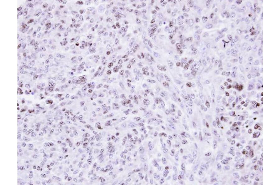 Immunohistochemistry - ZNF707 antibody from Signalway Antibody (22104) - Antibodies.com