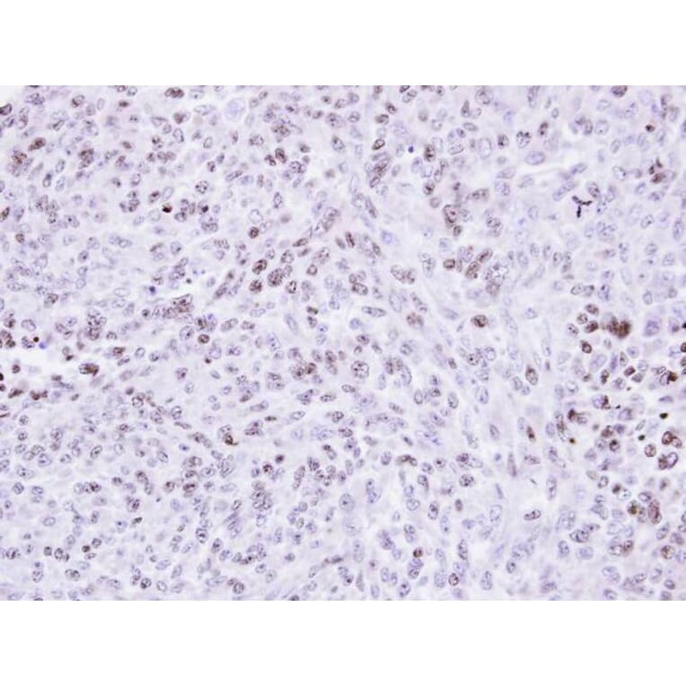 Immunohistochemistry - ZNF707 antibody from Signalway Antibody (22104) - Antibodies.com