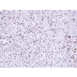 Immunohistochemistry - ZNF707 antibody from Signalway Antibody (22104) - Antibodies.com