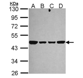 NDUFS2 antibody from Signalway Antibody (22112) - Antibodies.com