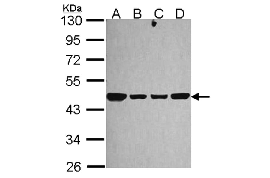 NDUFS2 antibody from Signalway Antibody (22112) - Antibodies.com
