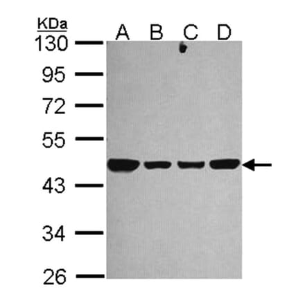 NDUFS2 antibody from Signalway Antibody (22112) - Antibodies.com