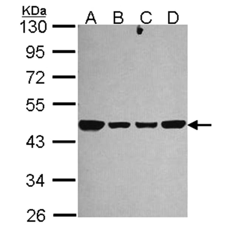 NDUFS2 antibody from Signalway Antibody (22112) - Antibodies.com