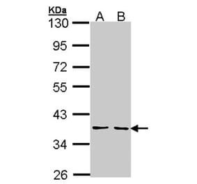 YKL-39 antibody from Signalway Antibody (22164) - Antibodies.com