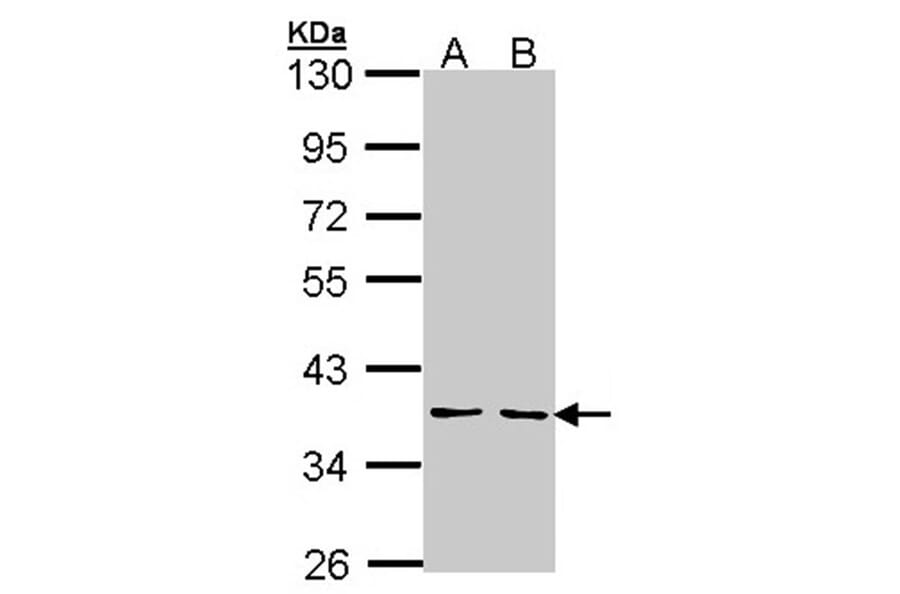 YKL-39 antibody from Signalway Antibody (22164) - Antibodies.com