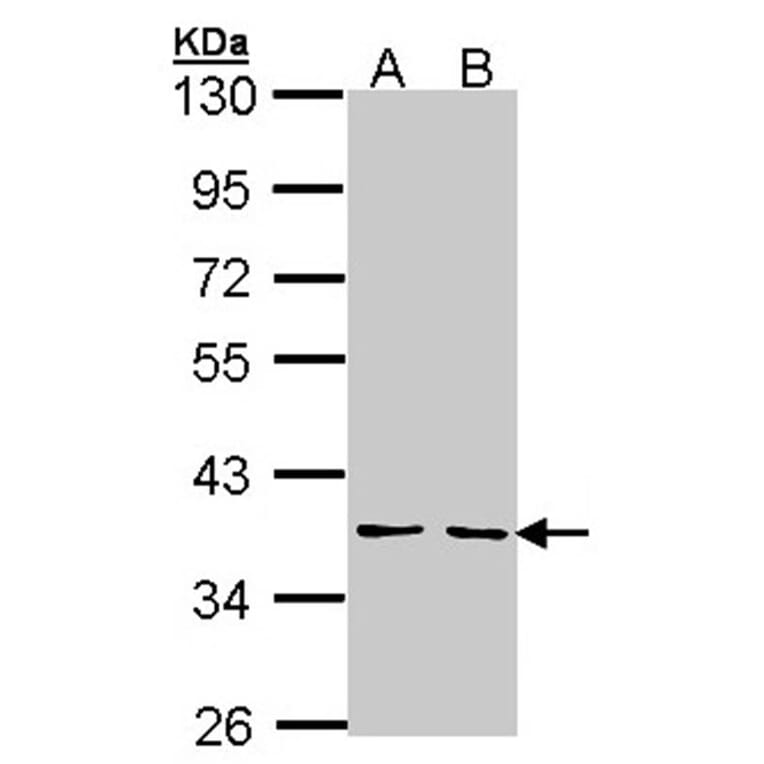 YKL-39 antibody from Signalway Antibody (22164) - Antibodies.com