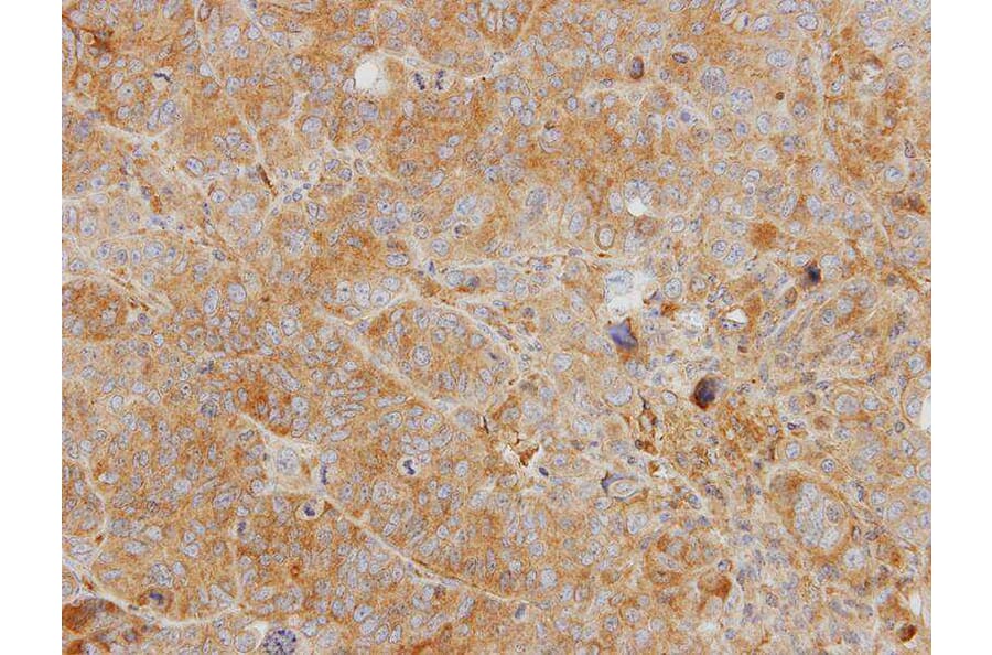 Immunohistochemistry - YKL-39 antibody from Signalway Antibody (22164) - Antibodies.com