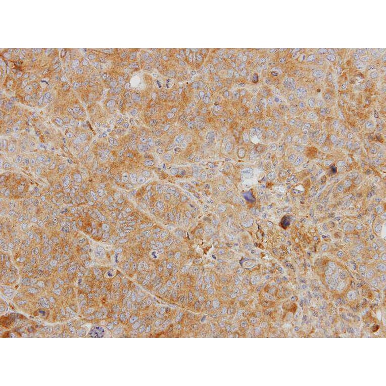 Immunohistochemistry - YKL-39 antibody from Signalway Antibody (22164) - Antibodies.com