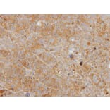 Immunohistochemistry - YKL-39 antibody from Signalway Antibody (22164) - Antibodies.com