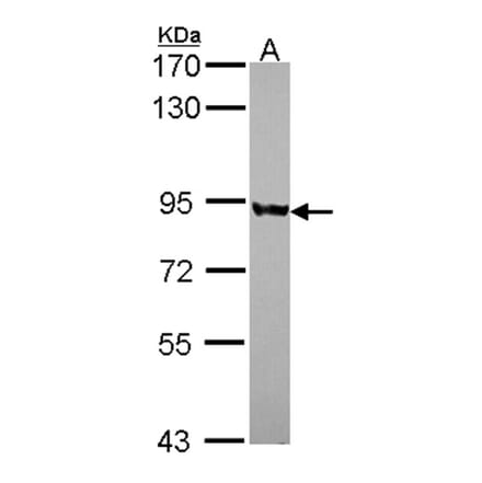 PNPase antibody from Signalway Antibody (22174) - Antibodies.com