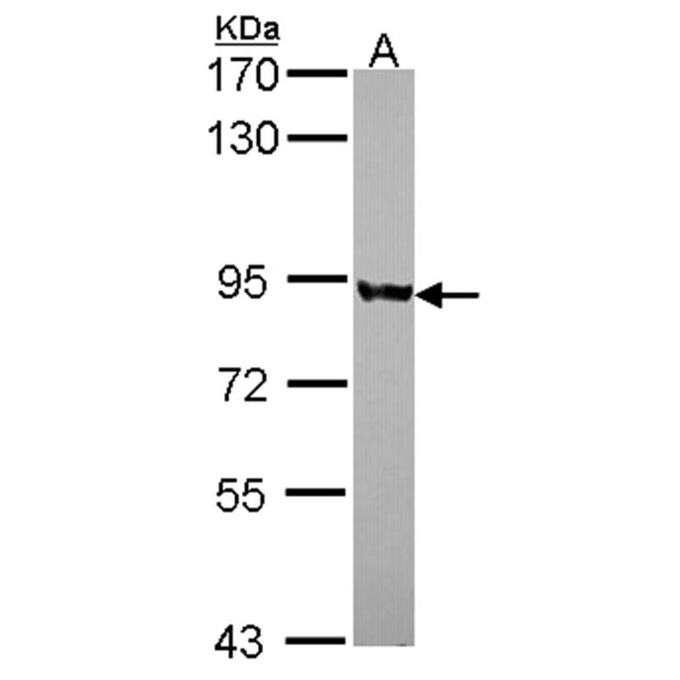 PNPase antibody from Signalway Antibody (22174) - Antibodies.com