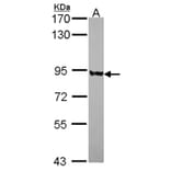 PNPase antibody from Signalway Antibody (22174) - Antibodies.com