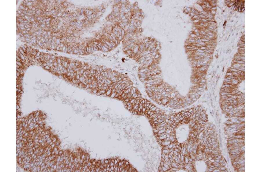 Immunohistochemistry - PNPase antibody from Signalway Antibody (22174) - Antibodies.com