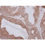 Immunohistochemistry - PNPase antibody from Signalway Antibody (22174) - Antibodies.com