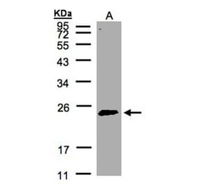 Rab 2 antibody from Signalway Antibody (22196) - Antibodies.com