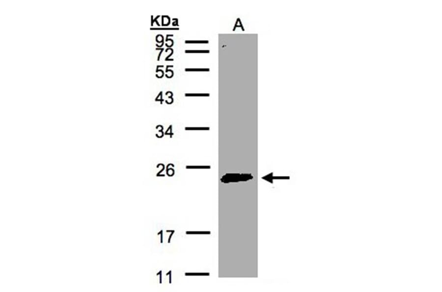 Rab 2 antibody from Signalway Antibody (22196) - Antibodies.com