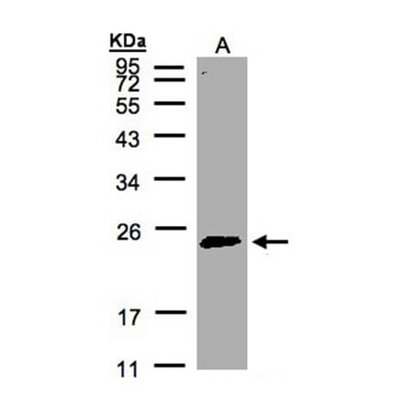 Rab 2 antibody from Signalway Antibody (22196) - Antibodies.com