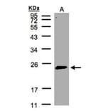 Rab 2 antibody from Signalway Antibody (22196) - Antibodies.com