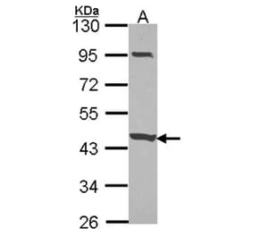 CCDC83 antibody from Signalway Antibody (22222) - Antibodies.com