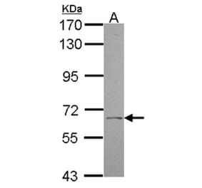 UGT1A antibody from Signalway Antibody (22250) - Antibodies.com