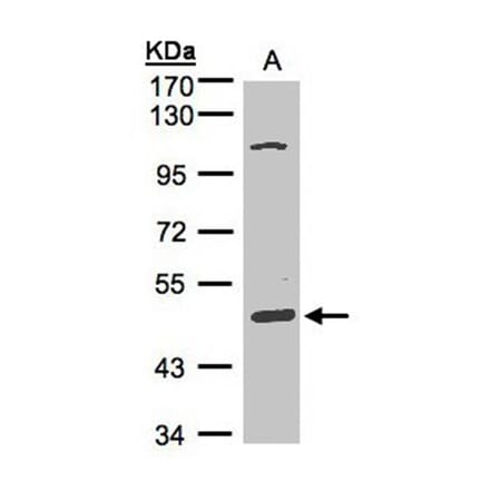 SCARA3 antibody from Signalway Antibody (22262) - Antibodies.com