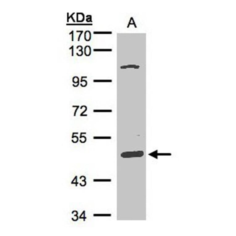 SCARA3 antibody from Signalway Antibody (22262) - Antibodies.com