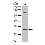 SCARA3 antibody from Signalway Antibody (22262) - Antibodies.com