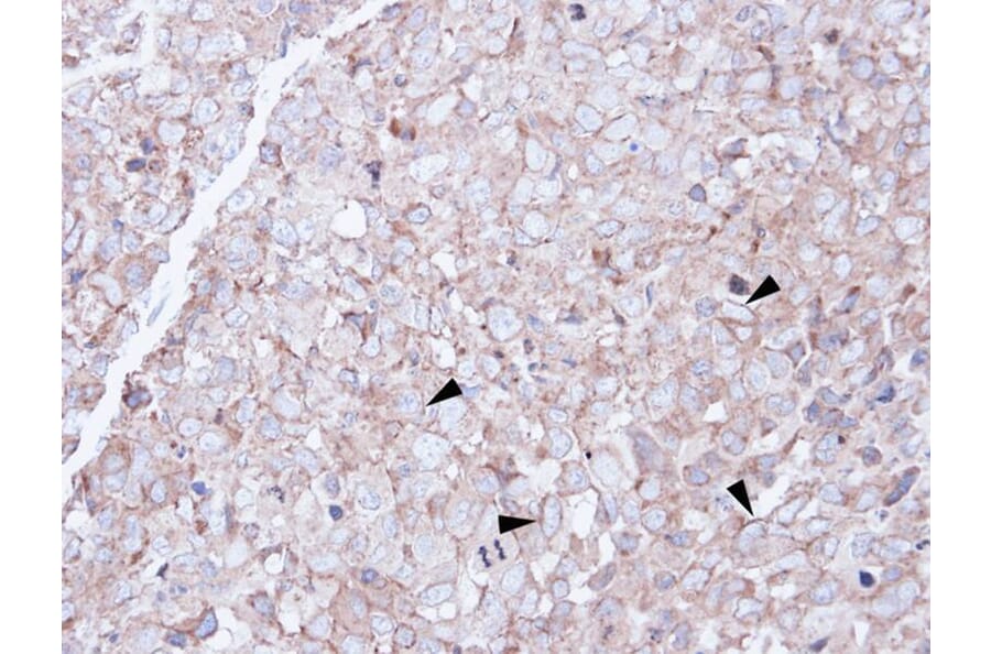 Immunohistochemistry - SCARA3 antibody from Signalway Antibody (22262) - Antibodies.com