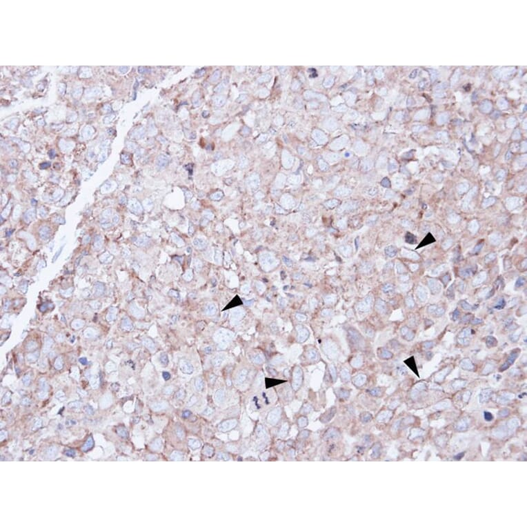 Immunohistochemistry - SCARA3 antibody from Signalway Antibody (22262) - Antibodies.com