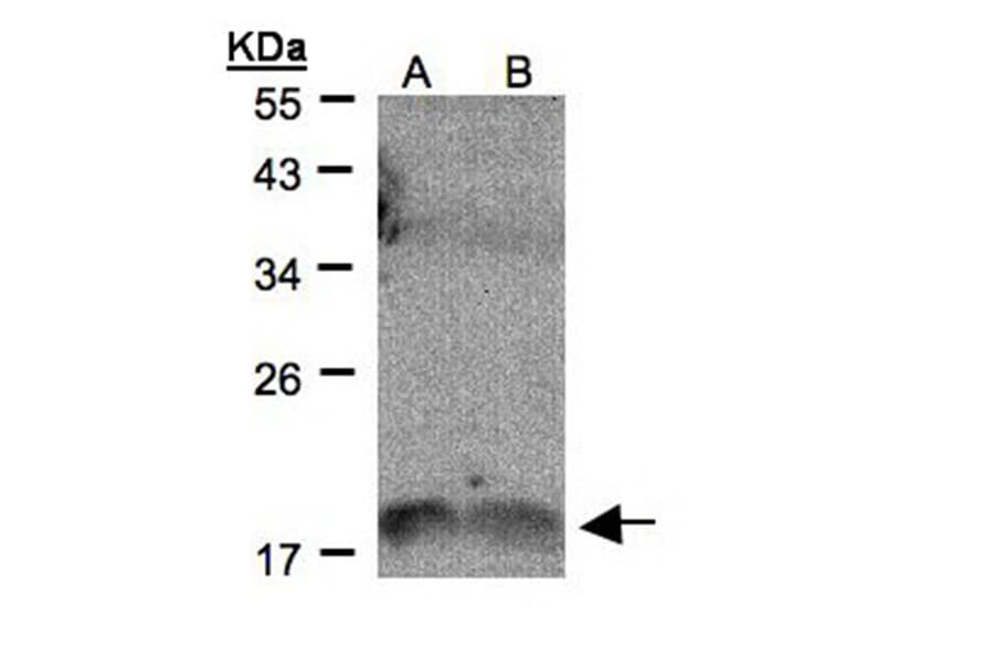IL-1F9 antibody from Signalway Antibody (22271) - Antibodies.com