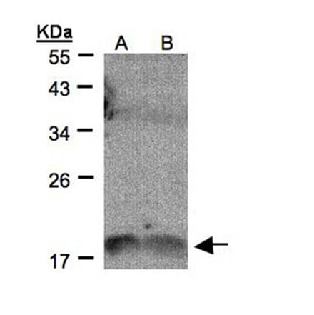 IL-1F9 antibody from Signalway Antibody (22271) - Antibodies.com