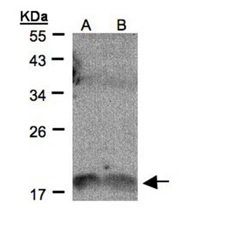IL-1F9 antibody from Signalway Antibody (22271) - Antibodies.com