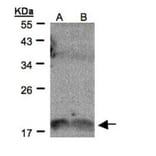 IL-1F9 antibody from Signalway Antibody (22271) - Antibodies.com