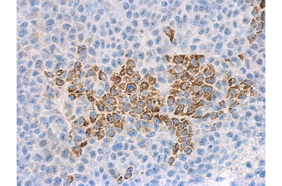 Immunohistochemistry - IL-1F9 antibody from Signalway Antibody (22271) - Antibodies.com