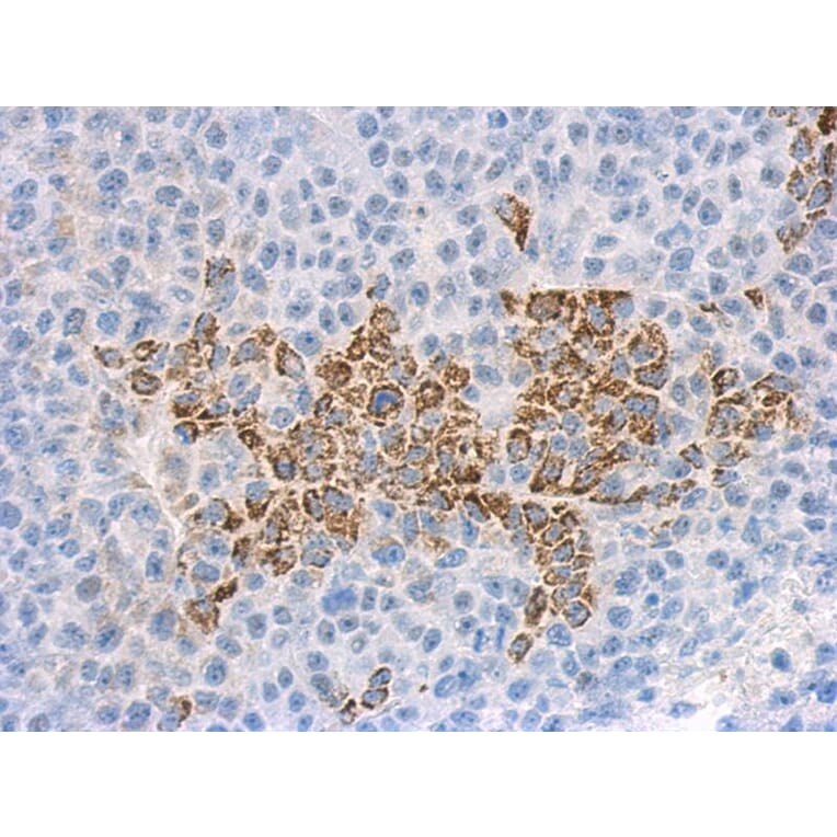 Immunohistochemistry - IL-1F9 antibody from Signalway Antibody (22271) - Antibodies.com