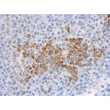 Immunohistochemistry - IL-1F9 antibody from Signalway Antibody (22271) - Antibodies.com