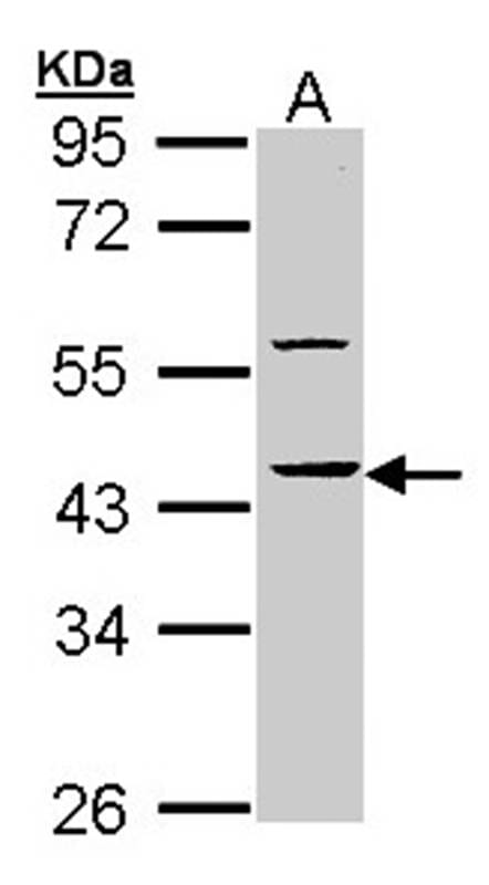 Sample (30 µg of whole cell lysate)  Molt-4 10% SDS PAGE Primary antibody diluted at 1: 10000