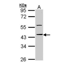 HS1BP3 antibody from Signalway Antibody (22311) - Antibodies.com