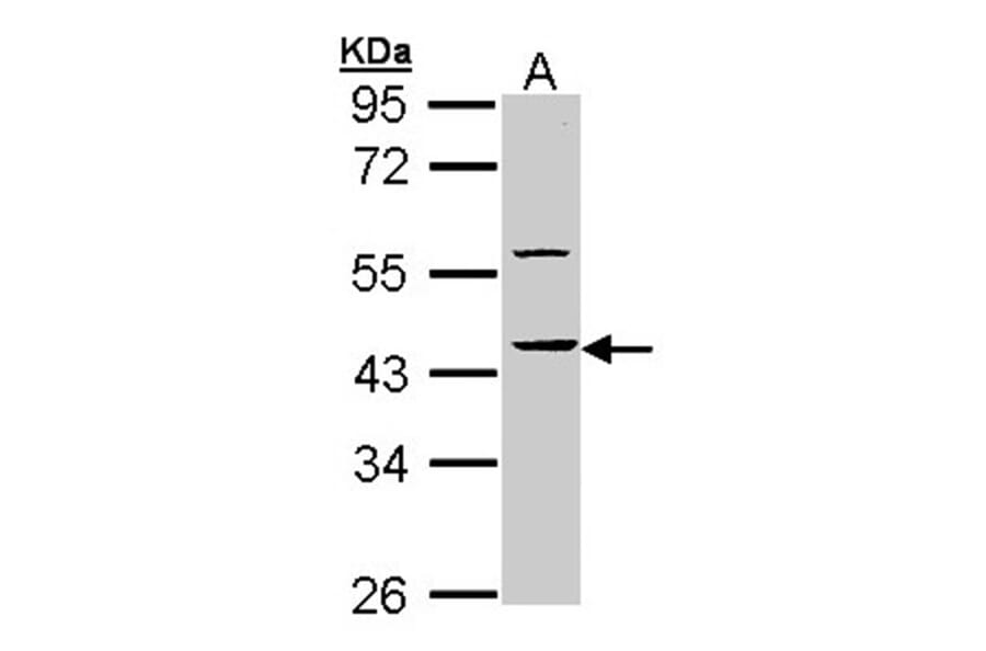 HS1BP3 antibody from Signalway Antibody (22311) - Antibodies.com