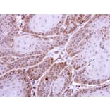 Immunohistochemistry - HS1BP3 antibody from Signalway Antibody (22311) - Antibodies.com