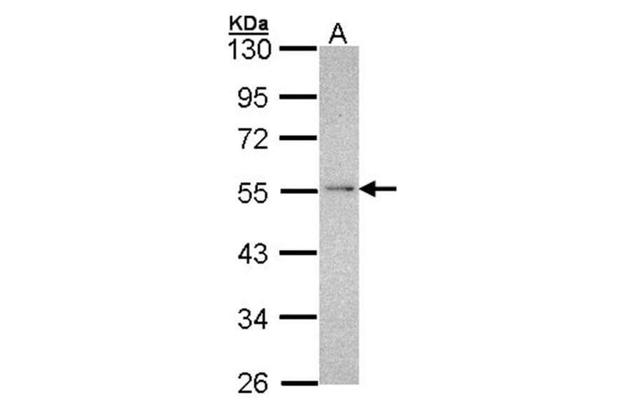 NDUFV1 antibody from Signalway Antibody (22341) - Antibodies.com