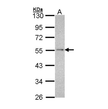 NDUFV1 antibody from Signalway Antibody (22341) - Antibodies.com