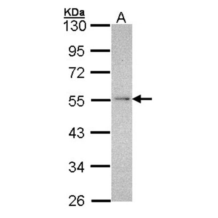 NDUFV1 antibody from Signalway Antibody (22341) - Antibodies.com