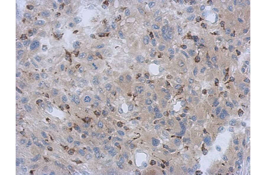 Immunohistochemistry - NDUFV1 antibody from Signalway Antibody (22341) - Antibodies.com