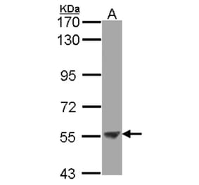 ENTPD3 antibody from Signalway Antibody (22361) - Antibodies.com