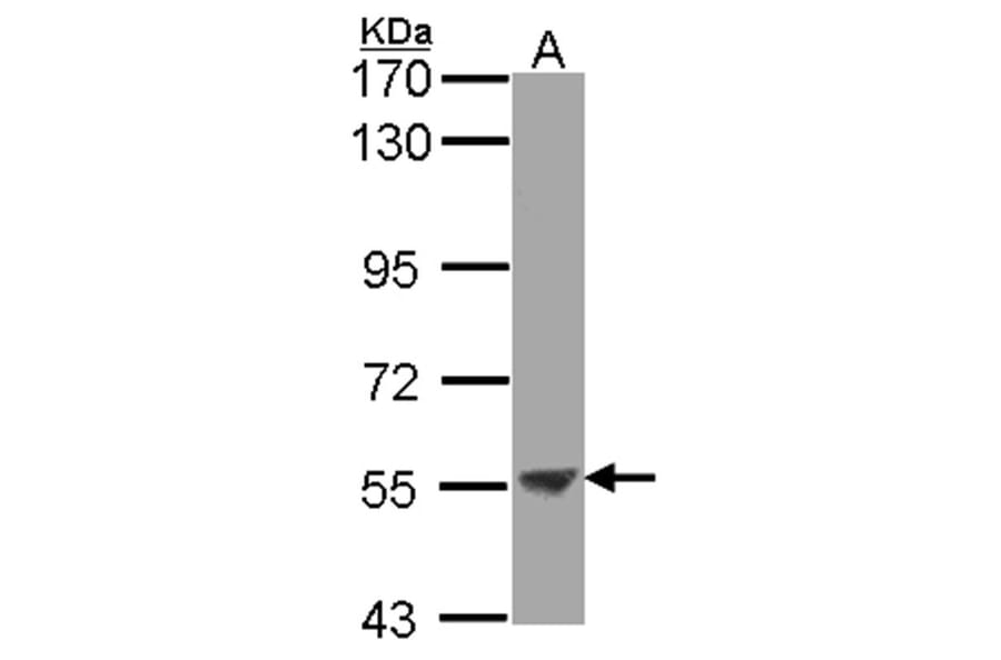 ENTPD3 antibody from Signalway Antibody (22361) - Antibodies.com