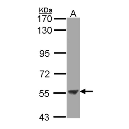 ENTPD3 antibody from Signalway Antibody (22361) - Antibodies.com